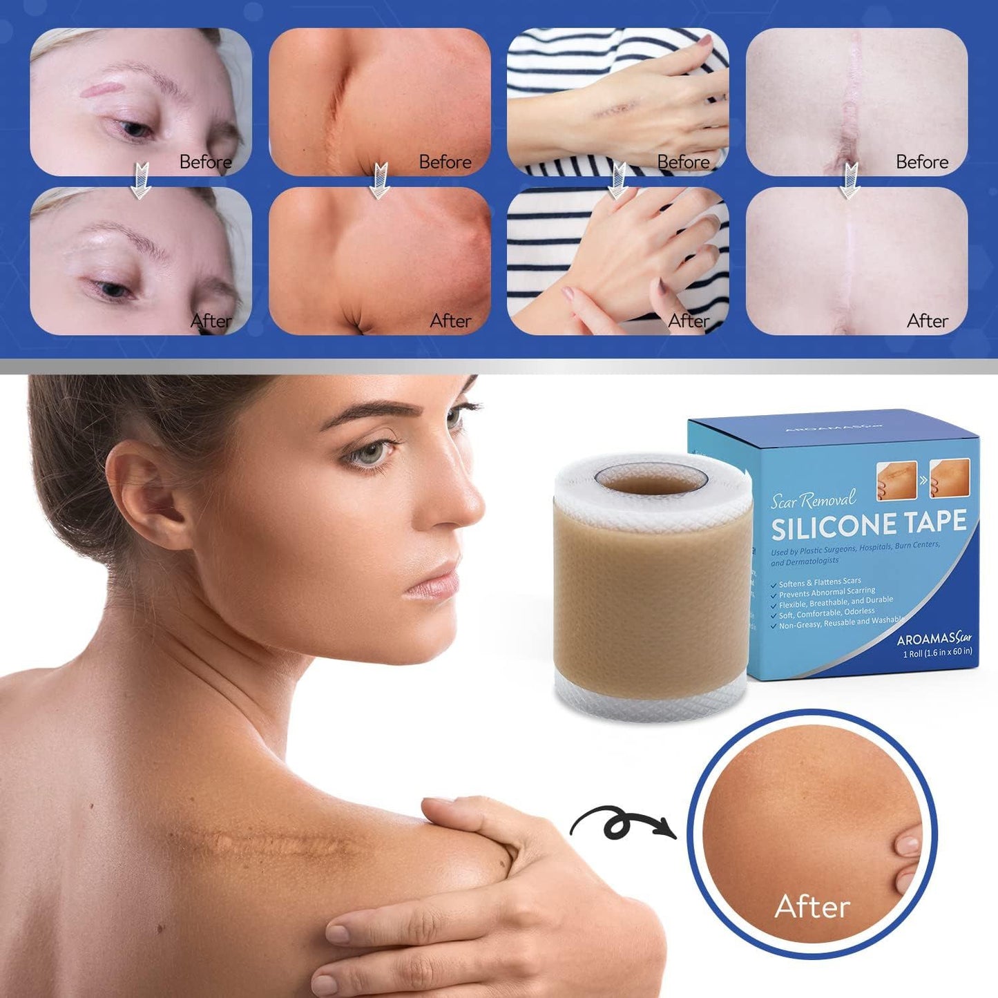 Silicone Scar Remover Tape for Acne & Wrinkles