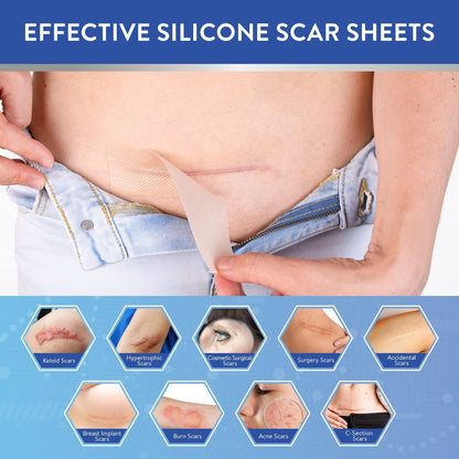 Silicone Scar Remover Tape for Acne & Wrinkles