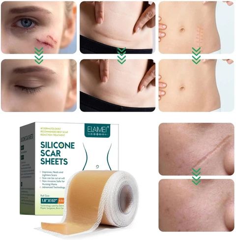Silicone Scar Remover Tape for Acne & Wrinkles