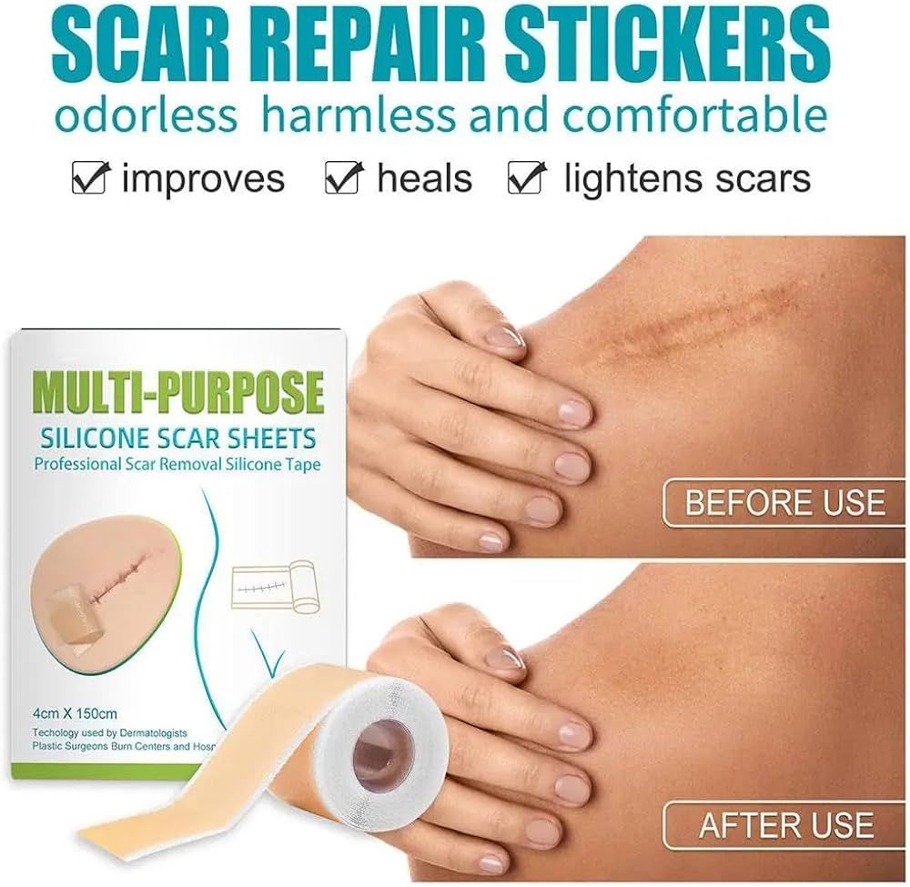 Silicone Scar Remover Tape for Acne & Wrinkles