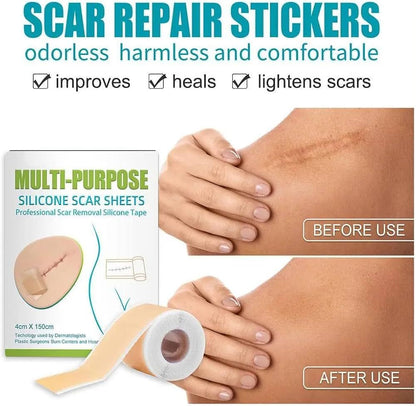 Silicone Scar Remover Tape for Acne & Wrinkles