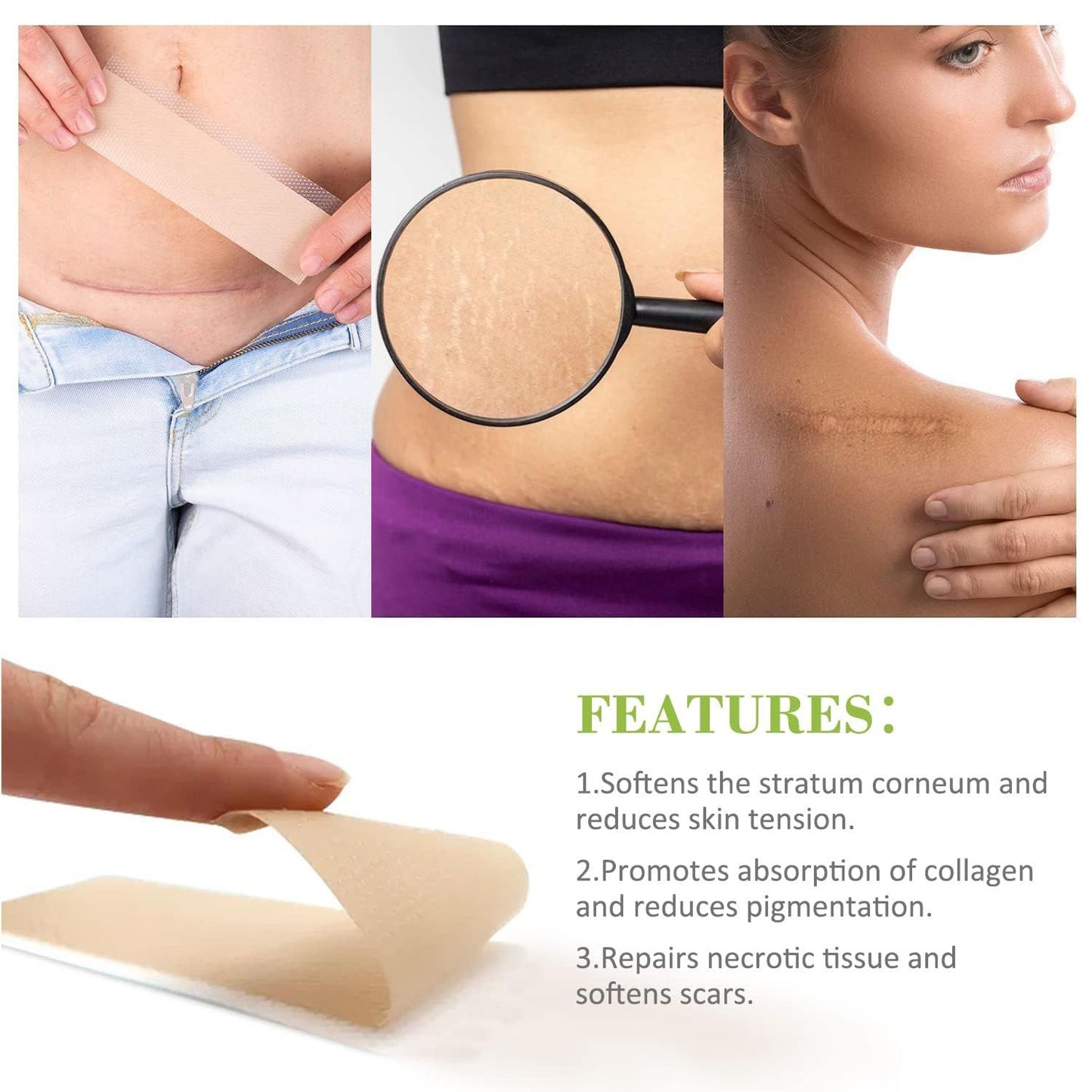 Silicone Scar Remover Tape for Acne & Wrinkles