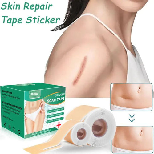 Silicone Scar Remover Tape for Acne & Wrinkles